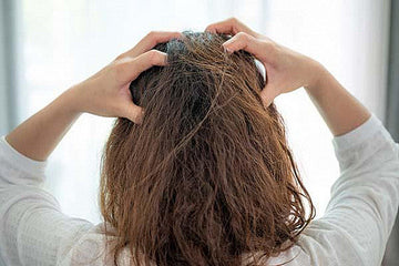 10 Common Causes of an Itchy Scalp